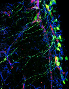 neuralstemcells.gif